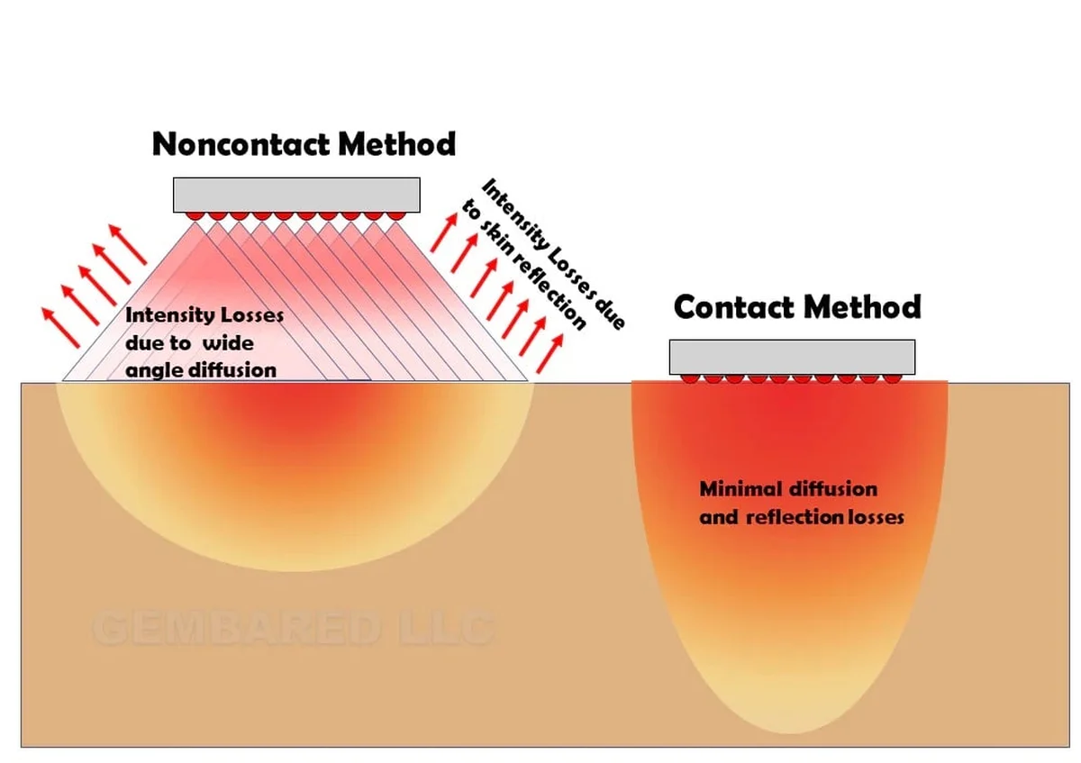 Comparison diagram of contact versus non-contact red light application on skin